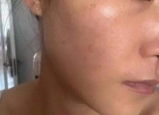 科學美白方法_皮膚暗沉原因_美白最有效的方法