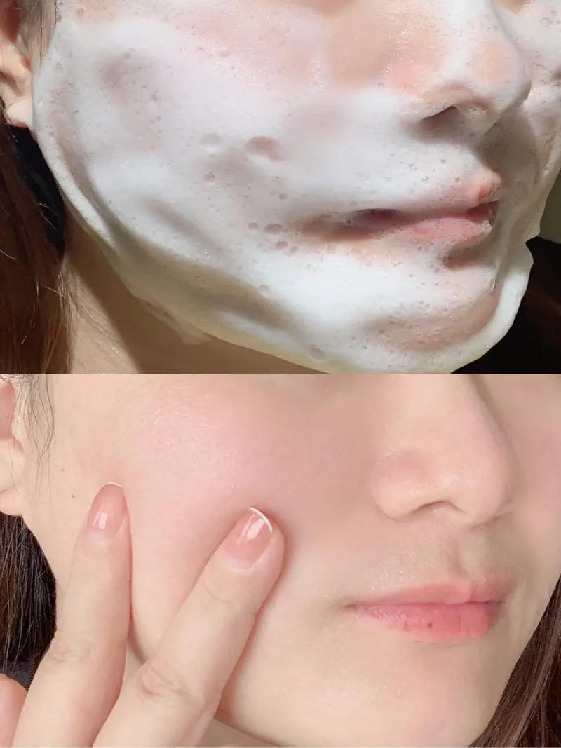 美白最有效的方法_皮膚暗沉原因_科學美白方法