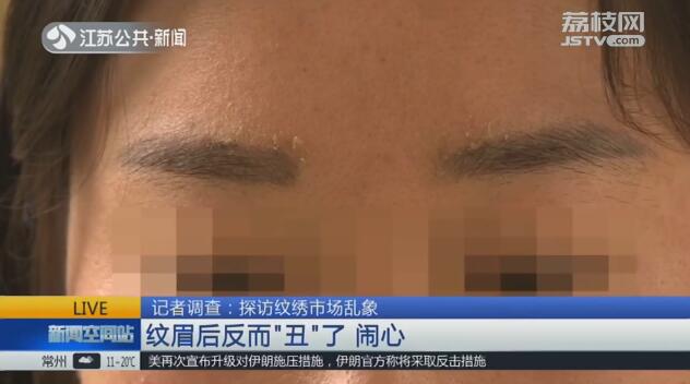 紋繡行業(yè)監(jiān)管空白_蘇州張家港紋眉失敗維權(quán)_紋繡閣紋眉怎么樣